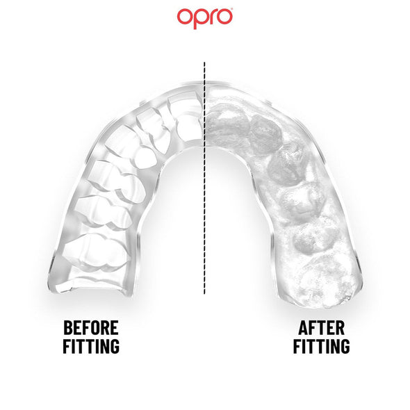 Opro Instant Custom Self Fit Mouthguard